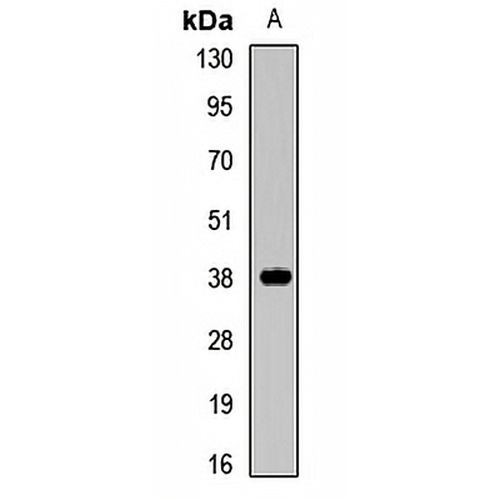 MFF Rabbit Polyclonal Antibody