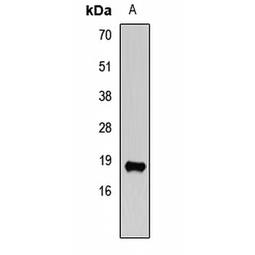 VAMP2 Rabbit Polyclonal Antibody
