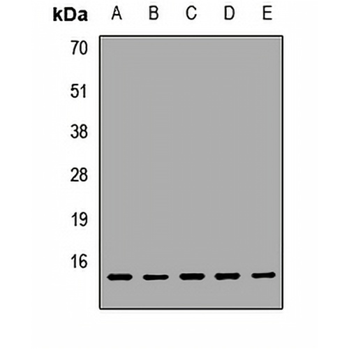 UQCRB Rabbit Polyclonal Antibody