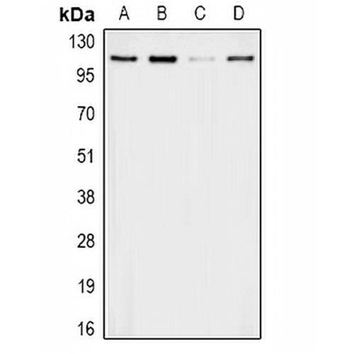 Apolipoprotein B Rabbit Polyclonal Antibody
