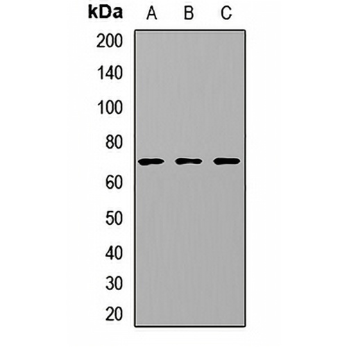 CETP Rabbit Polyclonal Antibody