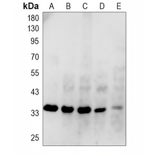 OGG1 Rabbit Polyclonal Antibody