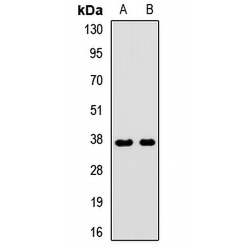 GNB3 Rabbit Polyclonal Antibody