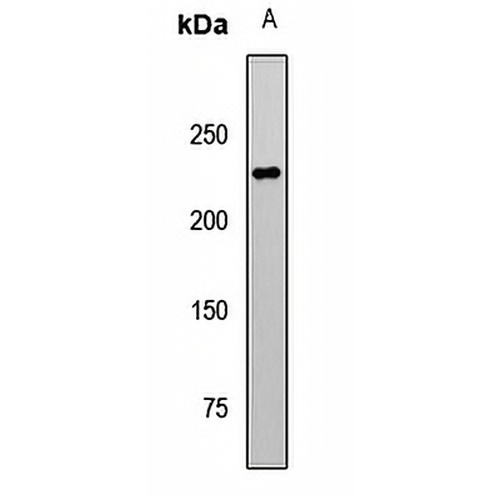 TET1 Rabbit Polyclonal Antibody