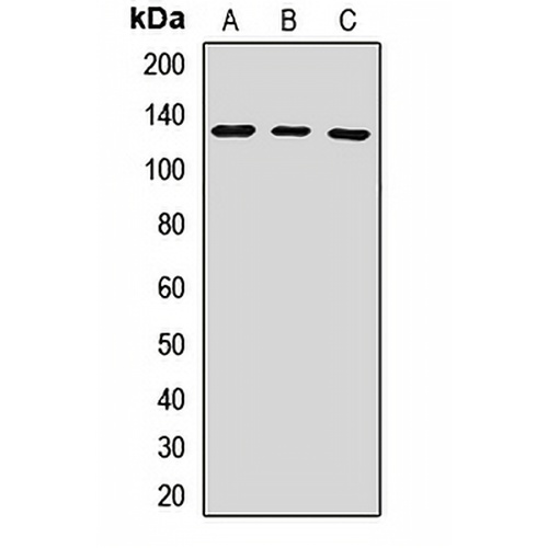 UPF1 Rabbit Polyclonal Antibody