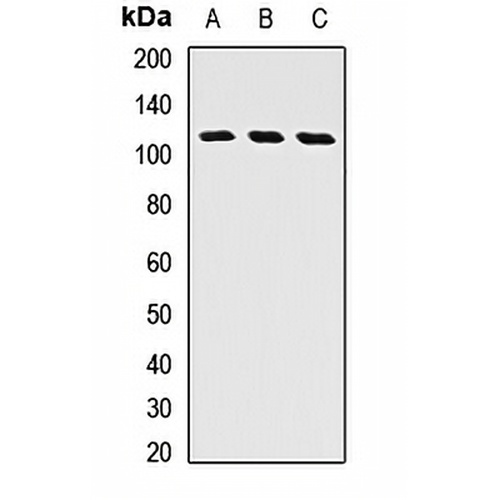 GGCX Rabbit Polyclonal Antibody