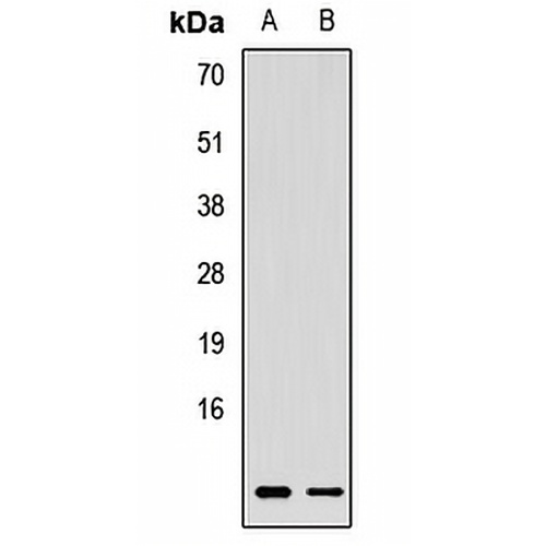 Rbx1 Rabbit Polyclonal Antibody