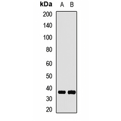 GNB1 Rabbit Polyclonal Antibody