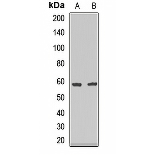 Endothelial Lipase Rabbit Polyclonal Antibody