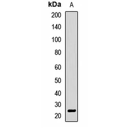 APCS Rabbit Polyclonal Antibody