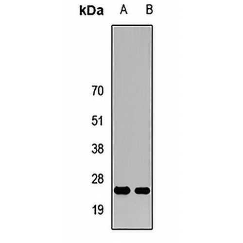 PRL3 Rabbit Polyclonal Antibody