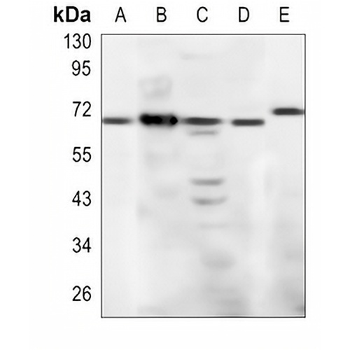 CD94 Rabbit Polyclonal Antibody