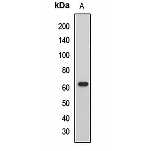 HCK Rabbit Polyclonal Antibody