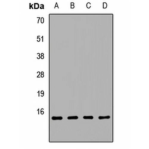 REG3 alpha Rabbit Polyclonal Antibody