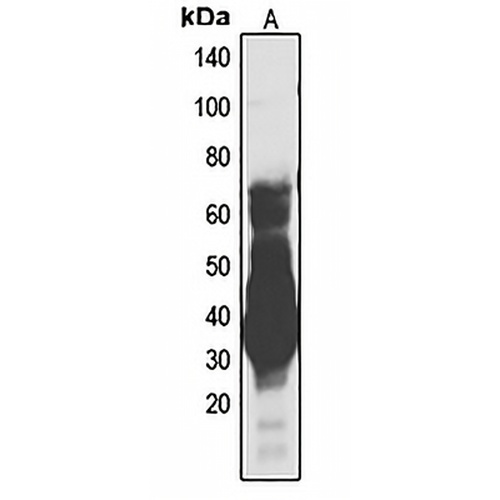 UBB Rabbit Polyclonal Antibody