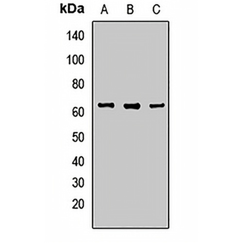 CARM1 Rabbit Polyclonal Antibody