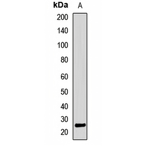 ALKBH7 Rabbit Polyclonal Antibody