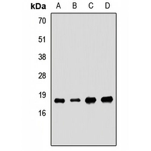 SKP1 Rabbit Polyclonal Antibody