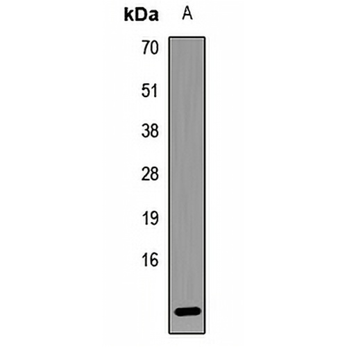 LAMTOR5 Rabbit Polyclonal Antibody