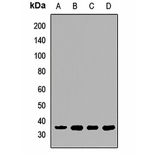 EB1 Rabbit Polyclonal Antibody