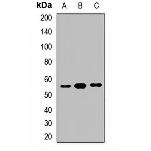 GPT Rabbit Polyclonal Antibody