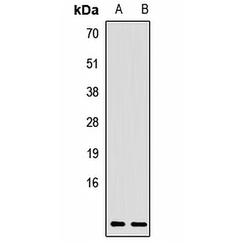 CCL17 Rabbit Polyclonal Antibody