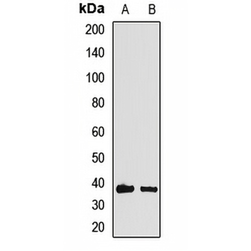 HOXA11 Rabbit Polyclonal Antibody