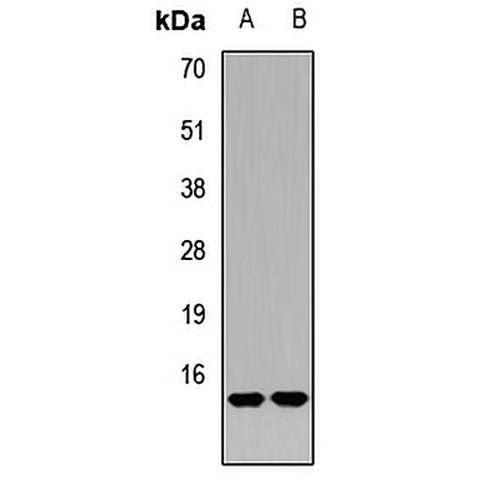 RAMP2 Rabbit Polyclonal Antibody