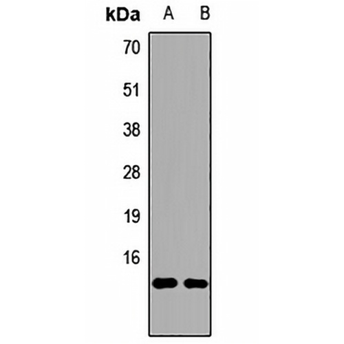 UBC Rabbit Polyclonal Antibody