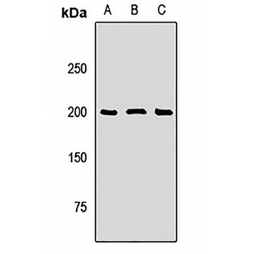 SOS1 Rabbit Polyclonal Antibody