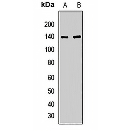 KIF5A Rabbit Polyclonal Antibody