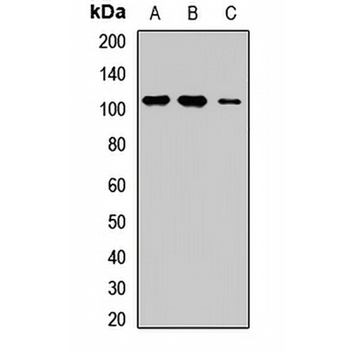ROR1 Rabbit Polyclonal Antibody
