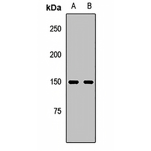 FANCI Rabbit Polyclonal Antibody