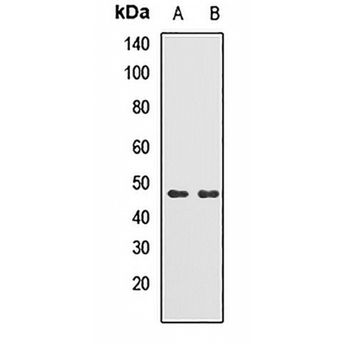 TRMT2B Rabbit Polyclonal Antibody