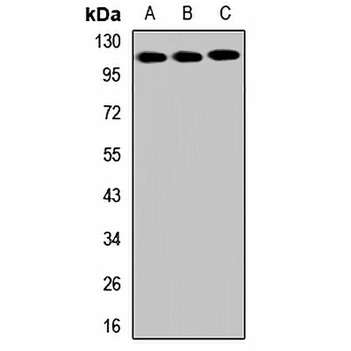 SLITRK6 Rabbit Polyclonal Antibody