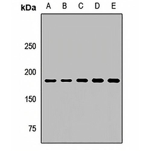 RhoGAP5 Rabbit Polyclonal Antibody