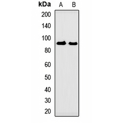 GUCY2D Rabbit Polyclonal Antibody