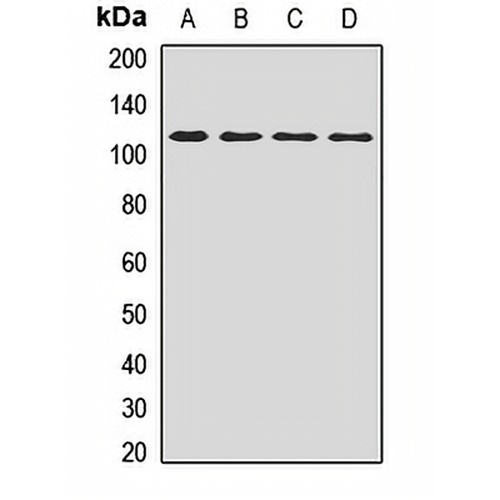 Polycystin 2 Rabbit Polyclonal Antibody
