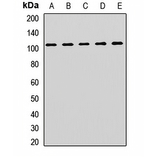 ACTN2 Rabbit Polyclonal Antibody