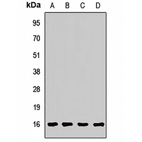ARF5 Rabbit Polyclonal Antibody