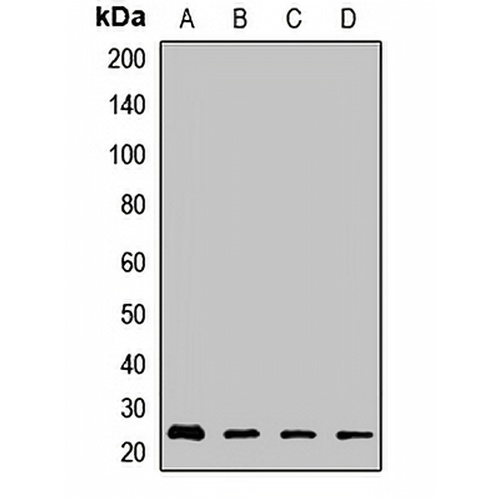 RhoGDI beta Rabbit Polyclonal Antibody