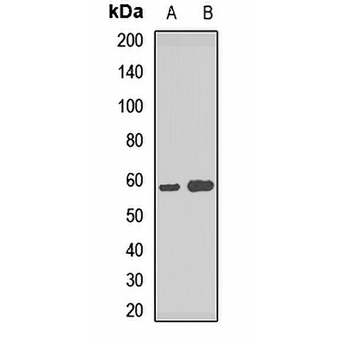 ATP6V1B2 Rabbit Polyclonal Antibody