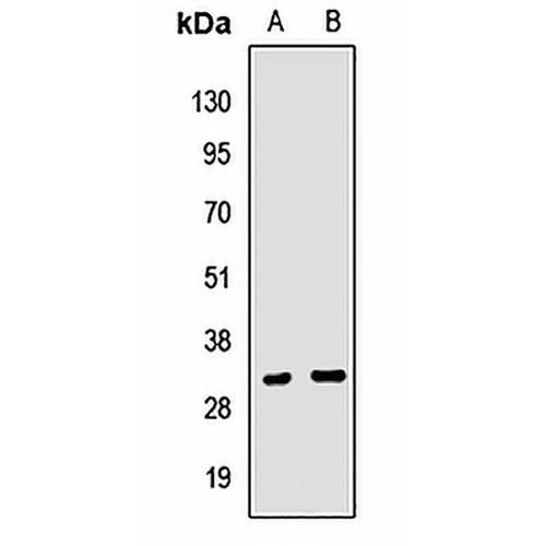 Clathrin Light Chain A Rabbit Polyclonal Antibody