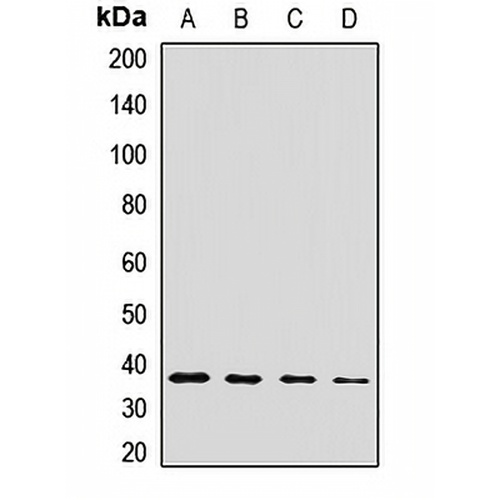 CPOX Rabbit Polyclonal Antibody