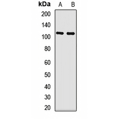 CYLD Rabbit Polyclonal Antibody