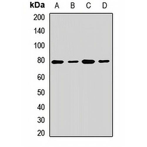 GFAT Rabbit Polyclonal Antibody