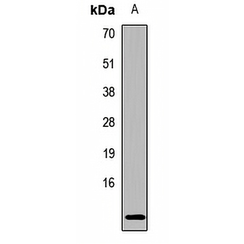 Hemoglobin epsilon Rabbit Polyclonal Antibody