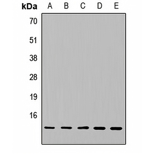 NDUFA5 Rabbit Polyclonal Antibody