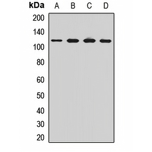 OSBP Rabbit Polyclonal Antibody