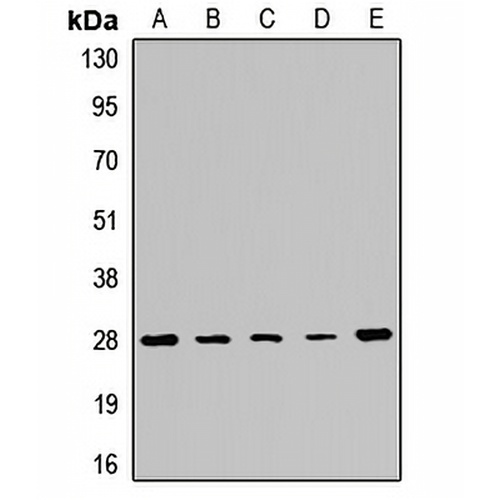 PMM2 Rabbit Polyclonal Antibody